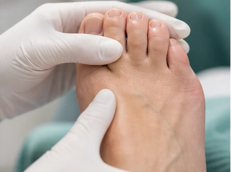 Controle van huid en nagels bij diabetes pedicure