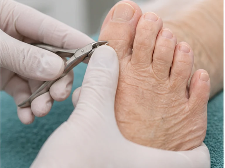 Teennagels knippen bij oudere cliënt
